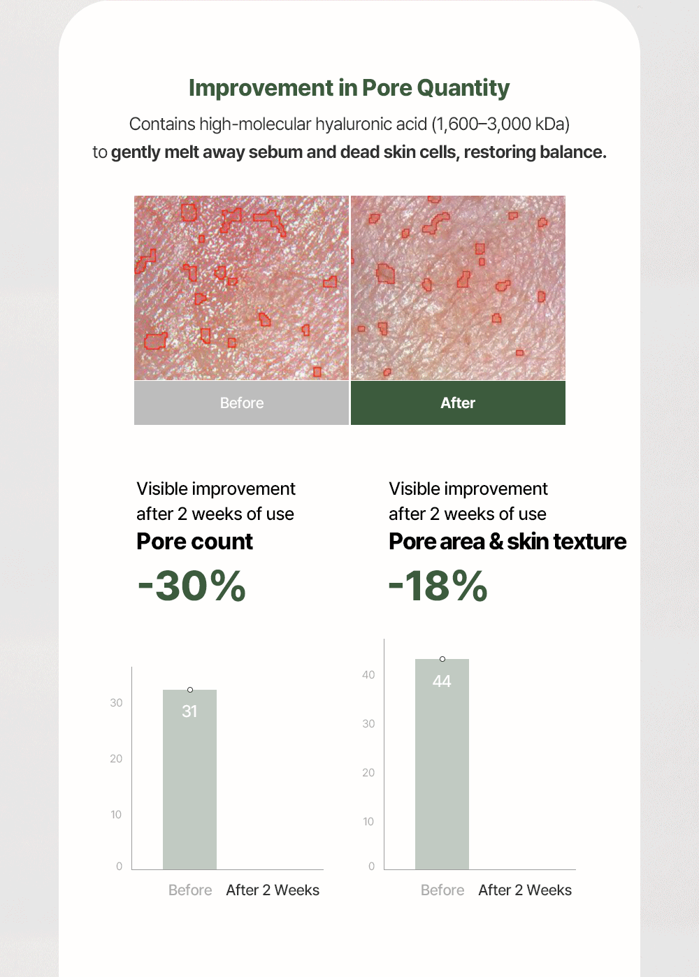 MULDREAM Vegan Green Mild Tea Tree Pore Mask
